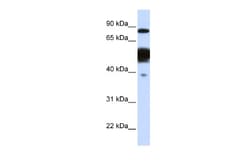 Nexilin Antibody, Novus Biologicals 0.05mg; Unlabeled:Antibodies, Polyclonal
